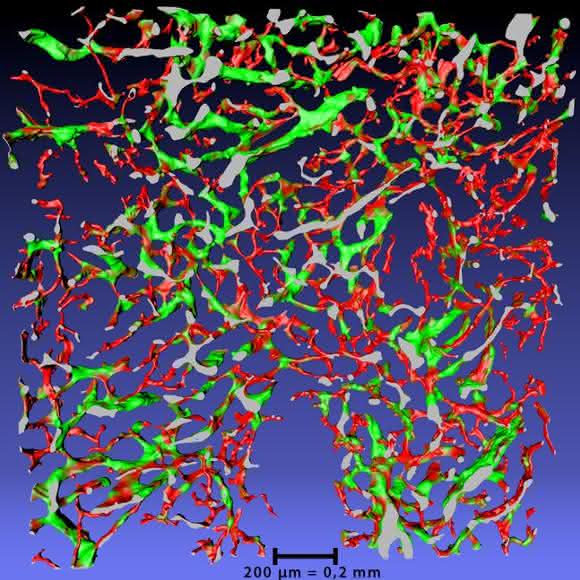 3D-Rekonstruktion von Blutgefäßen