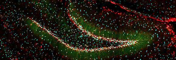 Bildung neuer Nervenzellen im Hippocampus der Maus. DBI (Diazepam binding inhibitor) ist rot gefärbt, die beiden Stammzellmarker Nestin und SOX2 sind grün und cyanblau markiert. (Quelle: Ionut Dumitru, DKFZ)