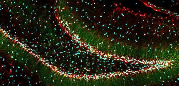 Bildung neuer Nervenzellen im Hippocampus der Maus. DBI (Diazepam binding inhibitor) ist rot gefärbt, die beiden Stammzellmarker Nestin und SOX2 sind grün und cyanblau markiert. (Quelle: Ionut Dumitru, DKFZ)