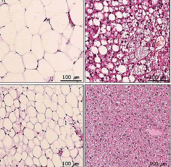 Die Behandlung mit Atglistatin reduziert Fettmasse und verhindert nicht-alkoholische Fettleber trotz fettreicher Ernährung. (Foto: Sohsuke Yamada)