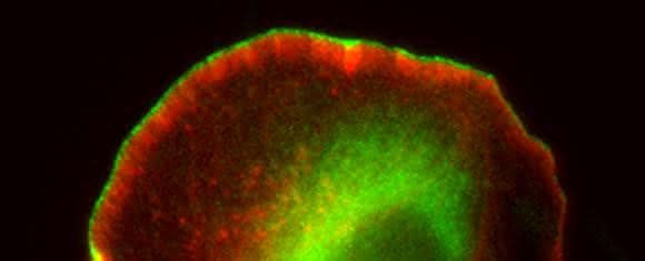 Melanomzelle bei der Wanderung, deren Bewegung nach oben links durch Formin-Proteine (grün) unterstützt wird. (© HZI / Frieda Kage)
