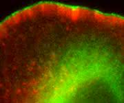 Melanomzelle bei der Wanderung, deren Bewegung nach oben links durch Formin-Proteine (grün) unterstützt wird. (© HZI / Frieda Kage)