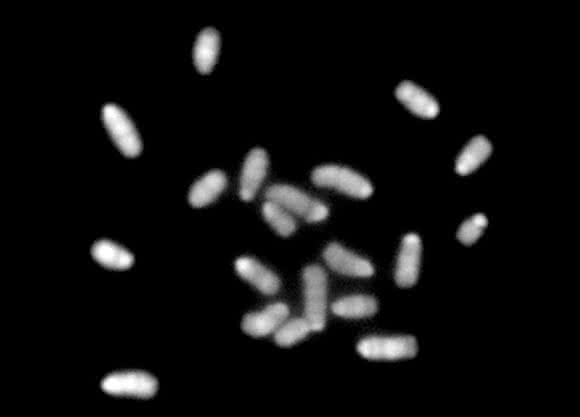Haploider Chromosomensatz