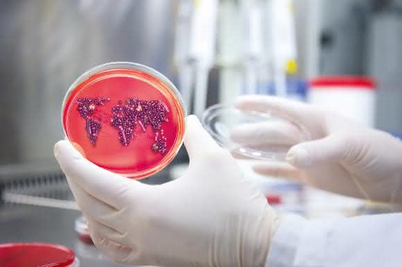 Zeitaufwendig: Bisher müssen Bakterien auf Nährboden gezüchtet werden, um Resistenzen zu erkennen. Spezielle Tests und Gendaten sollen schneller Gewissheit schaffen. (Foto: Curetis)