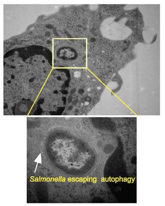 Salmonelle