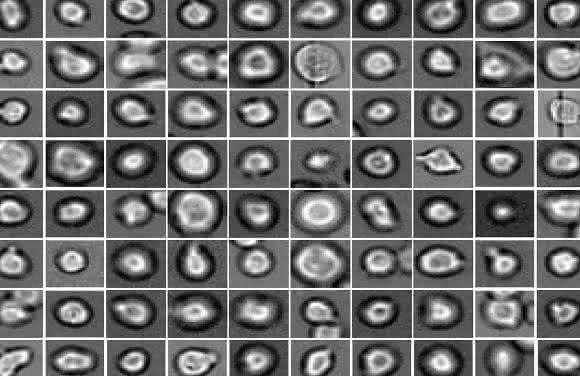 Was wohl aus ihnen wird? Blutstammzellen unter dem Mikroskop: Mit Hilfe neuer Methoden können Helmholtz-Wissenschaftler voraussagen, wie sie sich entwickeln werden. (Quelle: Helmholtz Zentrum München) Was wohl aus ihnen wird? Blutstammzellen unter dem Mikroskop: Mit Hilfe neuer Methoden können Helmholtz-Wissenschaftler voraussagen, wie sie sich entwickeln werden. (Quelle: Helmholtz Zentrum München)