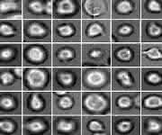 Was wohl aus ihnen wird? Blutstammzellen unter dem Mikroskop: Mit Hilfe neuer Methoden können Helmholtz-Wissenschaftler voraussagen, wie sie sich entwickeln werden. (Quelle: Helmholtz Zentrum München)