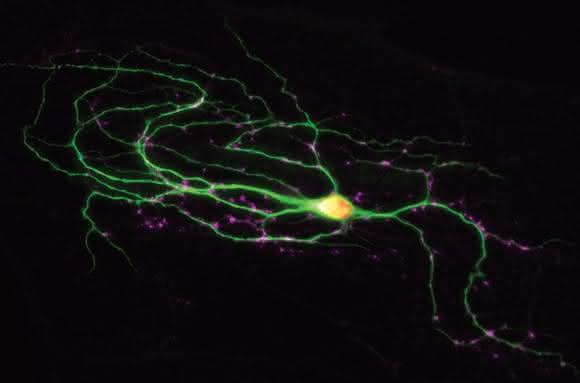 Eine fluoreszierende Nervenzelle (grün) in einer Zellkultur. An den rosa gefärbten Synapsen kommuniziert die Zelle mit ihren Partnern. (© MPI f. experimentelle Medizin)