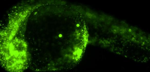 Fluoreszierende Kügelchen (grün) im 24 Stunden alten Zebrafischembryo. Die Kügelchen wurden im Einzellstadium in den Embryo eingebracht und verteilten sich, ohne die Entwicklung zu beeinflussen. (Copyright: Hörner et al. / Journal of Biophotonics) Fluoreszierende Kügelchen (grün) im 24 Stunden alten Zebrafischembryo. Die Kügelchen wurden im Einzellstadium in den Embryo eingebracht und verteilten sich, ohne die Entwicklung zu beeinflussen. (Copyright: Hörner et al. / Journal of Biophotonics)