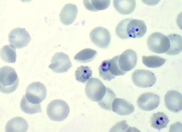 Malaria-Parasit Plasmodium falciparum