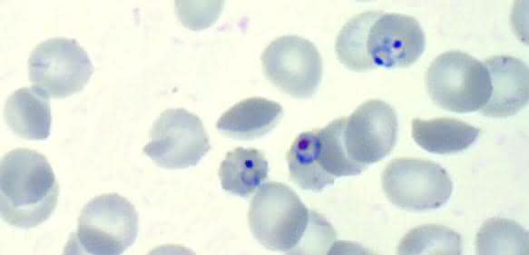 Malaria-Parasit Plasmodium falciparum