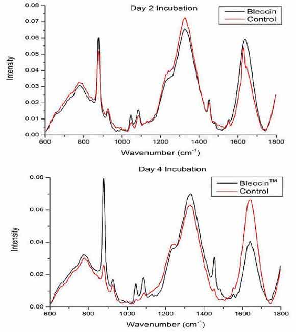 Cell Damage and Disease: Double-Stranded DNA Damage Assessed with Raman Spectroscopy
