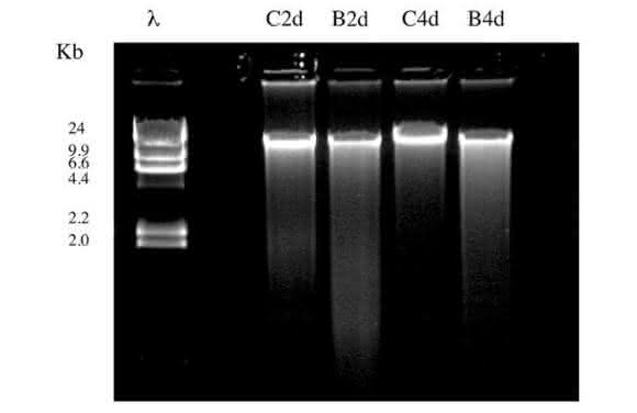 Cell Damage and Disease: Double-Stranded DNA Damage Assessed with Raman Spectroscopy