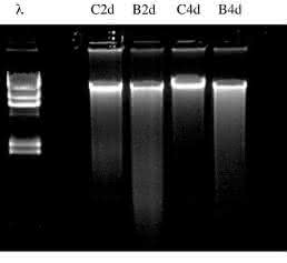Cell Damage and Disease: Double-Stranded DNA Damage Assessed with Raman Spectroscopy