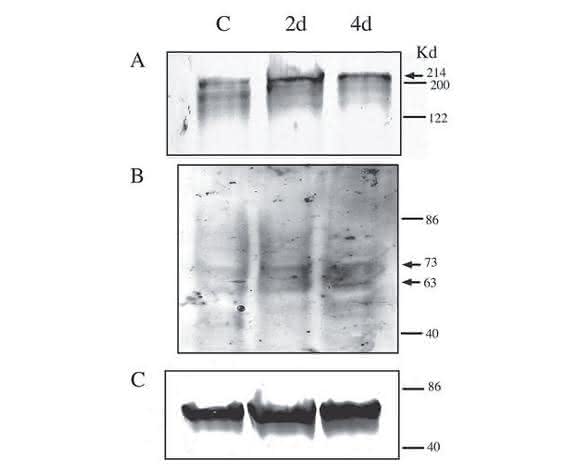 Cell Damage and Disease: Double-Stranded DNA Damage Assessed with Raman Spectroscopy