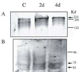 Cell Damage and Disease: Double-Stranded DNA Damage Assessed with Raman Spectroscopy