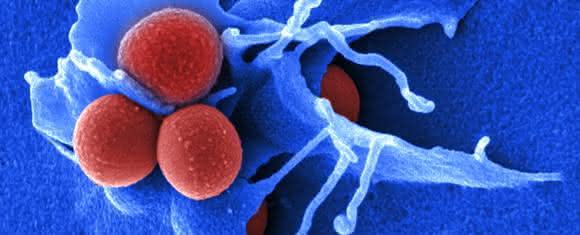 Elektronenmikroskopische Aufnahme von Staphylococcus aureus. (© HZI/Manfred Rohde) Elektronenmikroskopische Aufnahme von Staphylococcus aureus. (© HZI/Manfred Rohde)