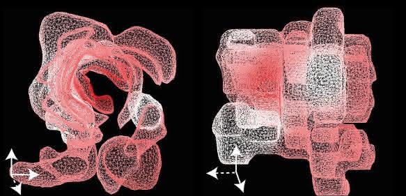 Das dreidimensionale Tumormodell zeigt, in welchen Arealen die Kopienzahl des Gens BRCA2 im Darmtumor verändert ist. Im inneren Tumorbereich fanden die Wissenschaftler besonders viele Kopien des Gens (dunkelrot), während in einigen äußeren Regionen die Kopienzahl kaum zunahm (hellrot) oder unverändert blieb (weiß). (© Christine Sers, Soulafa Mamlouk / Charité Berlin)