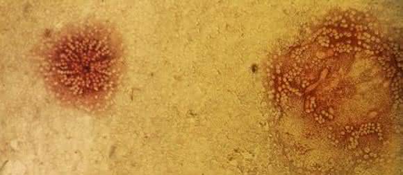 Staupe-Virus