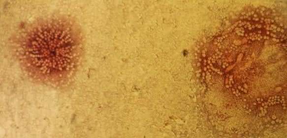 Staupe-Virus