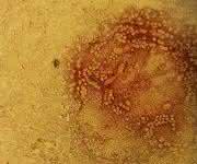 Staupe-Virus