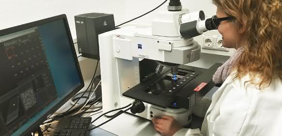 DNA-Schäden werden mikroskopisch analysiert