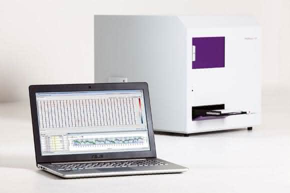Datenanalyse-Programm Genedata Screener®