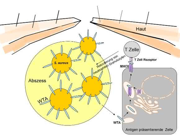 Das Zellhüllen-Zuckerpolymer Wandteichonsäure (WTA) von Staphylococcus aureus spielt bei der Entwicklung von Hautinfektionen eine Rolle. Das Zellhüllen-Zuckerpolymer Wandteichonsäure (WTA) von Staphylococcus aureus spielt bei der Entwicklung von Hautinfektionen eine Rolle.
