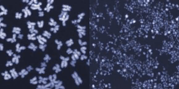 Menschliche Chromosomen im Mikroskop. Auf dem linken Bild sind die Chromosomen intakt, das rechte Bild zeigt kleingeschnittene Chromosomen aus Zellen, in denen das Enzym MUS81 unkontrolliert aktiv war. (Bild: ETH Zürich / Jiradet Gloggnitzer)