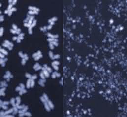 Menschliche Chromosomen im Mikroskop. Auf dem linken Bild sind die Chromosomen intakt, das rechte Bild zeigt kleingeschnittene Chromosomen aus Zellen, in denen das Enzym MUS81 unkontrolliert aktiv war. (Bild: ETH Zürich / Jiradet Gloggnitzer)