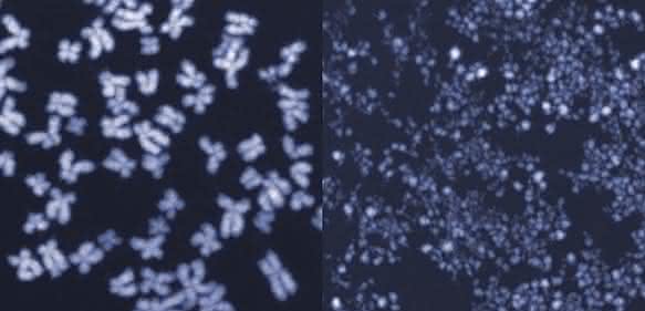 Menschliche Chromosomen im Mikroskop. Auf dem linken Bild sind die Chromosomen intakt, das rechte Bild zeigt kleingeschnittene Chromosomen aus Zellen, in denen das Enzym MUS81 unkontrolliert aktiv war. (Bild: ETH Zürich / Jiradet Gloggnitzer) Menschliche Chromosomen im Mikroskop. Auf dem linken Bild sind die Chromosomen intakt, das rechte Bild zeigt kleingeschnittene Chromosomen aus Zellen, in denen das Enzym MUS81 unkontrolliert aktiv war. (Bild: ETH Zürich / Jiradet Gloggnitzer)