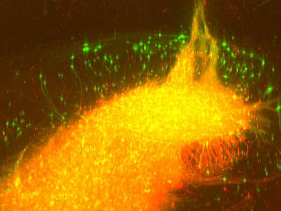 Nervenzellen im Hippocampus
