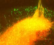 Nervenzellen im Hippocampus