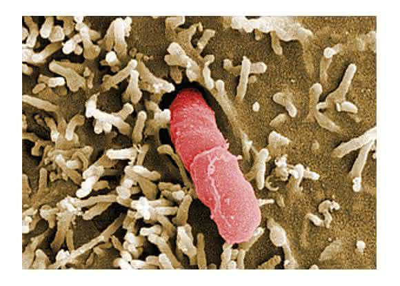 Yersinia pseudotuberculosis (© HZI/Manfred Rohde) Yersinia pseudotuberculosis (© HZI/Manfred Rohde)
