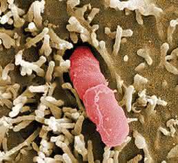 Yersinia pseudotuberculosis (© HZI/Manfred Rohde)