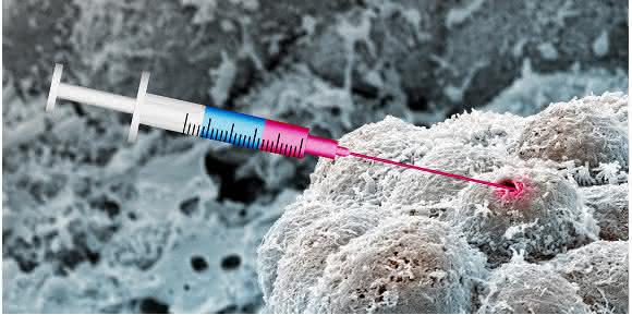 Illustration der Anti-Krebs-Wirkung der Arzneimittelkombination. (Bild: Evi Bieler, NanoImaging Lab, Universität Basel) Illustration der Anti-Krebs-Wirkung der Arzneimittelkombination. (Bild: Evi Bieler, NanoImaging Lab, Universität Basel)