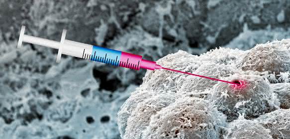 Illustration der Anti-Krebs-Wirkung der Arzneimittelkombination. (Bild: Evi Bieler, NanoImaging Lab, Universität Basel) Illustration der Anti-Krebs-Wirkung der Arzneimittelkombination. (Bild: Evi Bieler, NanoImaging Lab, Universität Basel)
