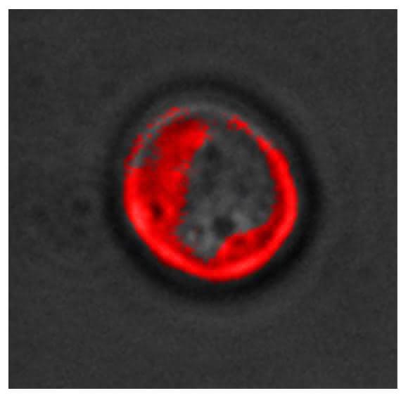 Leukämiezelle mit Färbung eines Oberflächenproteins. (Copyright: Universitätsklinikum Frankfurt) Leukämiezelle mit Färbung eines Oberflächenproteins. (Copyright: Universitätsklinikum Frankfurt)