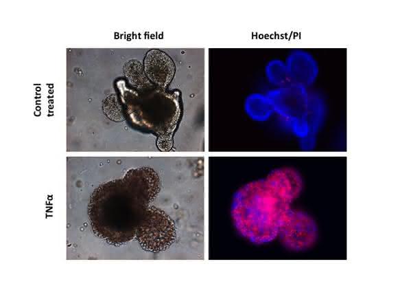 In der Zellkulturschale gezüchtete intestinale Organoide, in welchen mittels TNF-α Zelltod ausgelöst wurde. Die Anreicherung von roten Zellen belegt die Zelltod-auslösende Wirkung von TNF-α in den intestinalen Epithelzellen. In der Zellkulturschale gezüchtete intestinale Organoide, in welchen mittels TNF-α Zelltod ausgelöst wurde. Die Anreicherung von roten Zellen belegt die Zelltod-auslösende Wirkung von TNF-α in den intestinalen Epithelzellen.