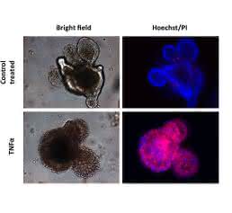 In der Zellkulturschale gezüchtete intestinale Organoide, in welchen mittels TNF-α Zelltod ausgelöst wurde. Die Anreicherung von roten Zellen belegt die Zelltod-auslösende Wirkung von TNF-α in den intestinalen Epithelzellen. In der Zellkulturschale gezüchtete intestinale Organoide, in welchen mittels TNF-α Zelltod ausgelöst wurde. Die Anreicherung von roten Zellen belegt die Zelltod-auslösende Wirkung von TNF-α in den intestinalen Epithelzellen.