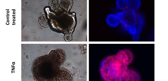 In der Zellkulturschale gezüchtete intestinale Organoide, in welchen mittels TNF-α Zelltod ausgelöst wurde. Die Anreicherung von roten Zellen belegt die Zelltod-auslösende Wirkung von TNF-α in den intestinalen Epithelzellen.