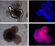 In der Zellkulturschale gezüchtete intestinale Organoide, in welchen mittels TNF-α Zelltod ausgelöst wurde. Die Anreicherung von roten Zellen belegt die Zelltod-auslösende Wirkung von TNF-α in den intestinalen Epithelzellen. In der Zellkulturschale gezüchtete intestinale Organoide, in welchen mittels TNF-α Zelltod ausgelöst wurde. Die Anreicherung von roten Zellen belegt die Zelltod-auslösende Wirkung von TNF-α in den intestinalen Epithelzellen.