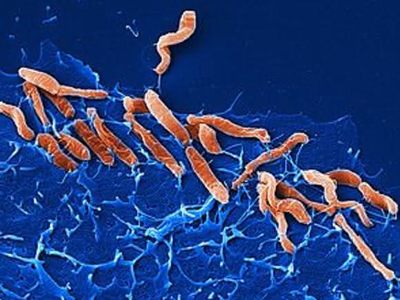 Helicobacter pylori