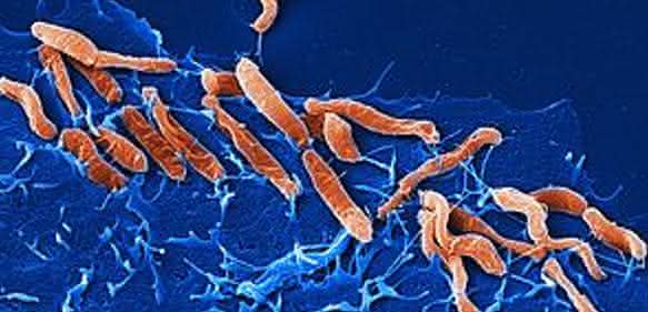 Helicobacter pylori