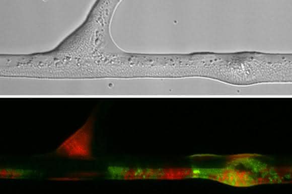 Durchlichtmikroskopische Aufnahme von Bakterien Durchlichtmikroskopische Aufnahme von Bakterien