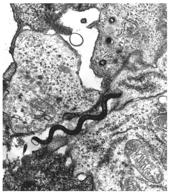 Elektronenmikroskop-Aufnahme eines Treponema-Bakteriums zwischen zwei Wirtszellen. (Bild: Steven J. Norris, UTHealth McGovern Medical School, Houston/USA)