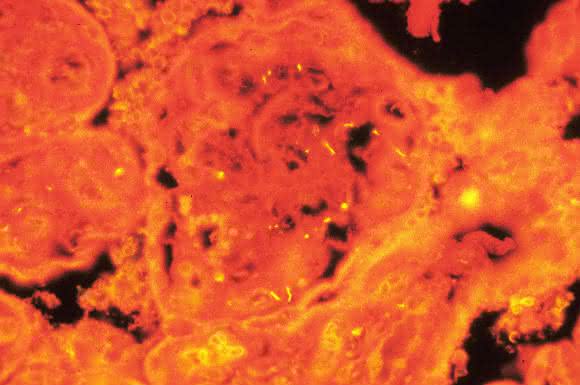 Immunofluoreszenz-Aufnahme eines Treponema-Bakteriums zwischen zwei Wirtszellen. (Bild: Steven J. Norris, UTHealth McGovern Medical School, Houston/USA) Immunofluoreszenz-Aufnahme eines Treponema-Bakteriums zwischen zwei Wirtszellen. (Bild: Steven J. Norris, UTHealth McGovern Medical School, Houston/USA)