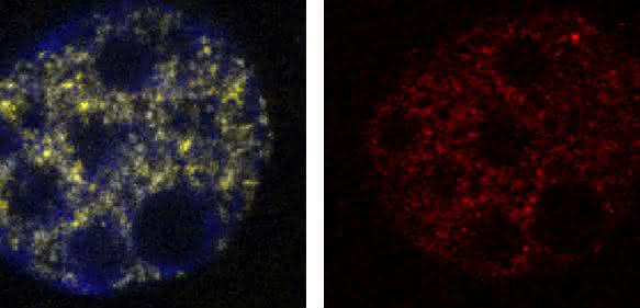 Die Abbildung zeigt einen normalen murinen Embryo (obere Reihe) und einen mit erhöhter Suv4-20 Expression (untere Reihe, Methylierung in Rot). Während die Zellen ohne Histon-Modifikationen ihre DNA verdoppeln (oben, wenige Zellen in Gelb) und dann zur Zellteilung voranschreiten, verharren die Zellen mit viel Suv4-20 in der Verdopplungsphase (zahlreiche gelbe Zellen) und können sich nicht mehr teilen. (Quelle: Helmholtz Zentrum München / Andre Eid) Die Abbildung zeigt einen normalen murinen Embryo (obere Reihe) und einen mit erhöhter Suv4-20 Expression (untere Reihe, Methylierung in Rot). Während die Zellen ohne Histon-Modifikationen ihre DNA verdoppeln (oben, wenige Zellen in Gelb) und dann zur Zellteilung voranschreiten, verharren die Zellen mit viel Suv4-20 in der Verdopplungsphase (zahlreiche gelbe Zellen) und können sich nicht mehr teilen. (Quelle: Helmholtz Zentrum München / Andre Eid)