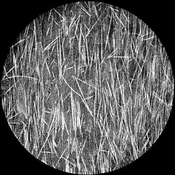 Micro-Computertomografisches Schnittbild