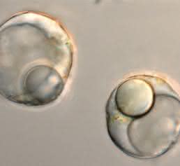 Eleocyten